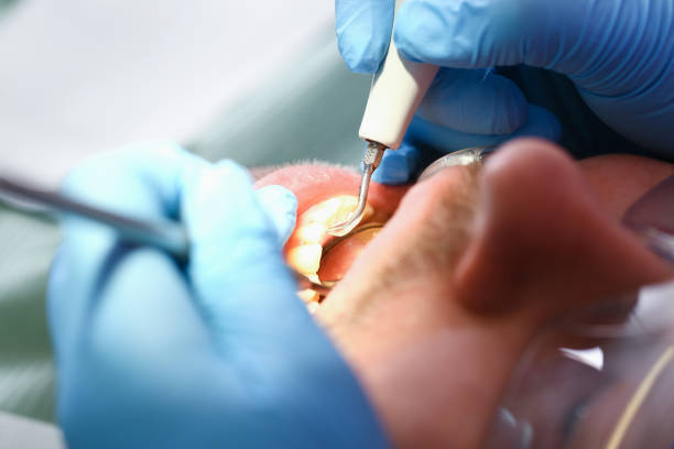 Best Emergency Root Canal Therapy in Oakwood, GA
