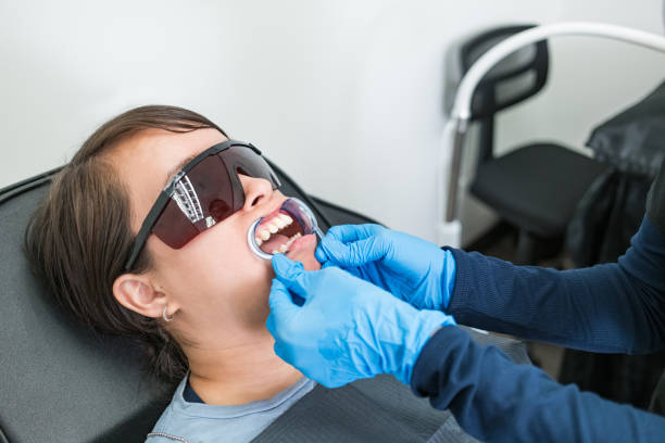 Best Knocked-Out Tooth (Avulsed Tooth) Treatment in Oakwood, GA
